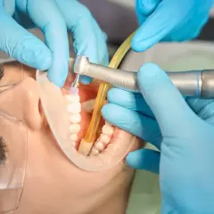 Dentysta wykonuje powtórne leczenie kanałowe, używając wiertła i ślinociągu. Pacjent ma założony koferdam i okulary ochronne.