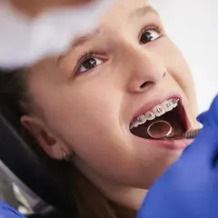 Dziewczynka z aparatem na zębach u dentysty, badanie jamy ustnej lusterkiem.