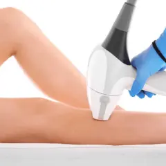 Depilacja laserowa: Jakie odstępy między zabiegami?