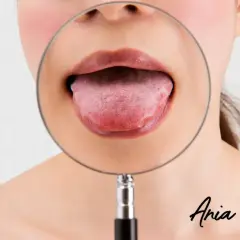 Powiększony pypeć na języku pod lupą. Czy to coś poważnego?