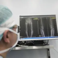 Ortopeda w masce i czepku analizuje na monitorze zdjęcia RTG kolan i kości udowych.