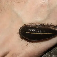 Une sangsue de rivière s'est accrochée au pied, une rencontre désagréable lors d'une baignade.