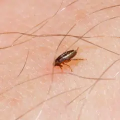 Cómo saber si tengo pulgas en mi cama: señales que no debes ignorar