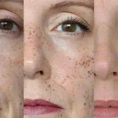 Trzy zbliżenia twarzy z piegami. Widać, jak można je subtelnie podkreślić, by nadać cerze naturalnego blasku i **cultivate** jej piękno.