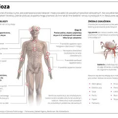 Borelioza objawy po latach - jak nieleczona choroba wpływa na zdrowie?