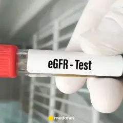 Rękawiczka trzyma probówkę z napisem "eGFR - Test". To badanie ocenia funkcję nerek.