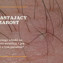 Kiedy rośnie zarost? Wiek, etapy i indywidualny rozwój