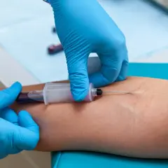 Pobieranie krwi do badania. Podwyższone CRP może wskazywać na stany zapalne, infekcje, a także przy jakich nowotworach jest podwyższone CRP.