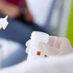 Ręka w rękawiczce trzyma pojemnik na próbkę do cytologii płynnej. W tle widać pacjentkę.