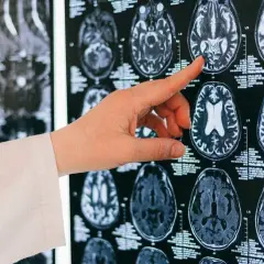 Guz mózgu objawy psychiczne - niebagatelizuj tych sygnałów zdrowotnych