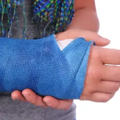 Po złamaniu nadgarstka, tytanowa płytka wspiera rehabilitację. Ręka w niebieskim gipsie.