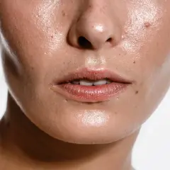 Primer plano de un rostro con piel brillante y húmeda, mostrando poros y pecas. Una imagen que inspira a buscar cómo quitar la grasa de la cara.