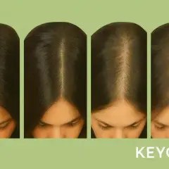 Cuatro imágenes muestran cómo crece el pelo, desde una línea capilar más densa hasta una más fina, ilustrando el proceso.