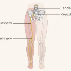 Der Ischiasnerv verläuft vom Kreuzbein durch das Bein bis zum Schienbein.