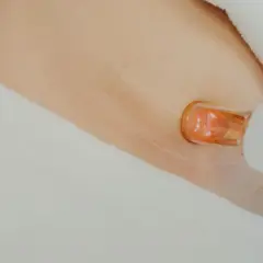 Närbild på hud med laserbehandling för bristningar. En vit apparat med orange spets närmar sig huden.