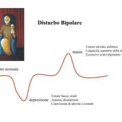 Illustrazione del disturbo bipolare tipo 1: un grafico mostra fluttuazioni dell'umore tra mania ed euforia e depressione, con un'immagine simbolica di una figura seduta con maschere.
