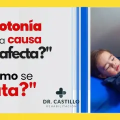 Entendiendo la hipotonía muscular: causas, síntomas y tratamientos esenciales
