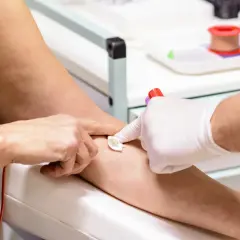 Woda gazowana przed badaniem krwi? Ekspert wyjaśnia, dlaczego nie!