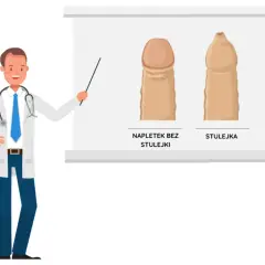 Jak rozciągać napletek bez bólu – bezpieczne metody i porady