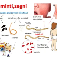Immagine illustra vermi intestinali e i loro sintomi: dermatiti, prurito anale, anemia.