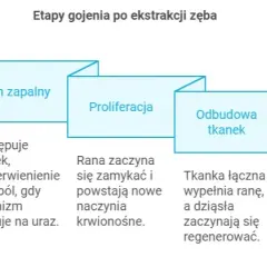 Regeneracja dziąsła po ekstrakcji: Szybkie gojenie i bezpieczeństwo