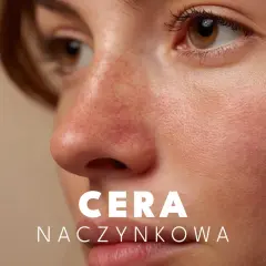 Delikatna skóra z widocznymi naczynkami. Dowiedz się, jak dbać o cerę naczynkową, by była zdrowa i promienna.