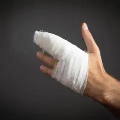 Dłoń z zabandażowanym kciukiem po zwichnięciu. Biały opatrunek obejmuje palec i część dłoni.