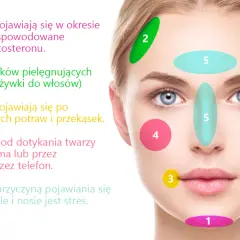 Pryszcze na policzkach: Co oznaczają i jak skutecznie walczyć?