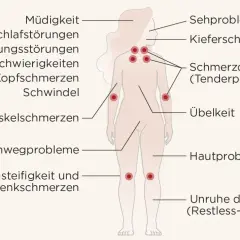 Übersicht der Symptome bei Fibromyalgie: Müdigkeit, Schmerzen, Schlafstörungen, Konzentrationsprobleme und Schmerzdruckpunkte (Tenderpoints) sind typisch.