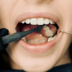 Antybiotyk na ząb z ropą: Co działa i kiedy do dentysty?