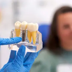Co robi dentysta? Kompleksowy przewodnik po zdrowiu uśmiechu