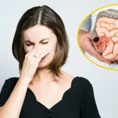 Kobieta zatyka nos, czując nieprzyjemny zapach. Obok model jelit, sugerujący częste gazy i potencjalny rak.