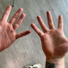 Manos con callos visibles, evidencia de trabajo duro o entrenamiento.