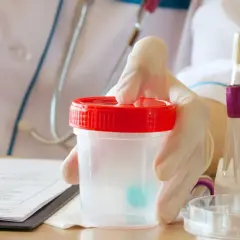 Rękawiczka trzyma pojemnik na mocz. W tle probówki i dokumentacja medyczna, sugerujące analizę pod kątem erytrocytów w moczu.