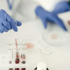 Badacz w niebieskich rękawiczkach pobiera próbkę krwi do analizy. Może to być związane z diagnostyką mykoplazma objawy.