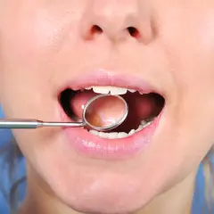 Usta kobiety z lusterkiem dentystycznym, badanie złamanego zęba przy dziąśle. Cena zabiegu może być różna.