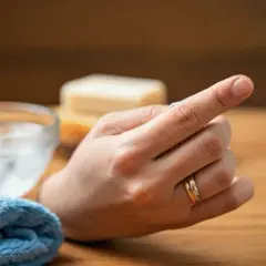Jak zdjąć obrączkę z opuchniętego palca? Poradnik krok po kroku