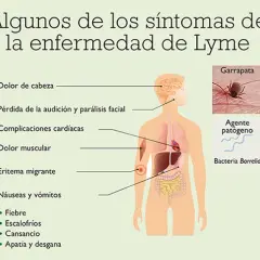 Síntomas de Lyme: Identifica los signos tempranos y evita complicaciones