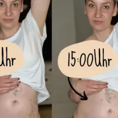 Endometrioza brzuch jak balon – przyczyny wzdęć i skuteczne metody łagodzenia