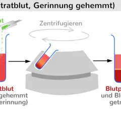 Blutprobe wird mit Citrat versetzt, zentrifugiert, um Blutplasma und Blutzellen zu trennen. Ein schneller Wert für die Analyse.