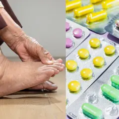 Dna moczanowa: Szybka ulga bez recepty i kiedy iść do lekarza?