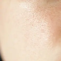 Zbliżenie na skórę twarzy, ukazujące widoczne pory. To naturalne otwory, przez które skóra oddycha i wydziela sebum.