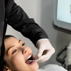 Dentysta w białej rękawiczce zakłada pacjentce przezroczyste nakładki. Na ekranie widoczny jest model uzębienia. Znieczulenie powierzchniowe nie jest widoczne, ale proces może być jego częścią.
