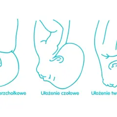 Jak rozpoznać ułożenie dziecka do porodu i uniknąć komplikacji?