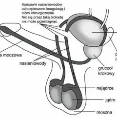 Czy wazektomia to grzech? Moralne dylematy i nauka Kościoła