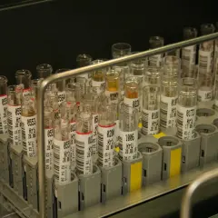 Nie każda probówka jest taka sama. Jak wybrać odpowiednią do profesjonalnego laboratorium?