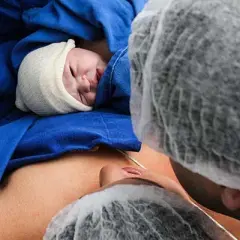 Czy cesarka to operacja? Poznaj prawdę o cesarskim cięciu