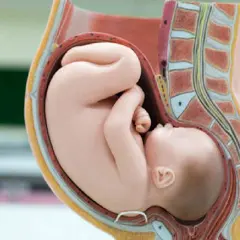 Model anatomiczny pokazuje prawidłowe ułożenie dziecka do porodu – główka skierowana w dół, zgięta.