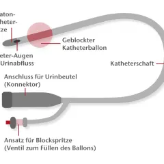 Schema eines Katheters für den Mann: Nélaton-Spitze, Ballon, Anschluss für Urinbeutel und Ansatz für Blockspritze.