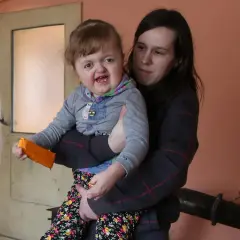 Matka trzyma dziecko z zespołem Aperta. Dziewczynka ma pomarańczową zabawkę.